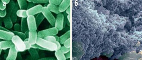 Пробиотические Lactobacillus reuteri и лечение меланомы