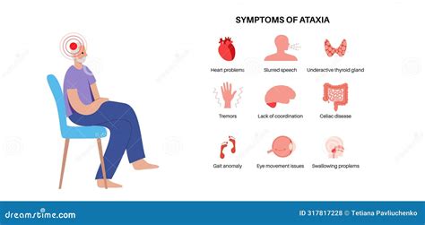 Ataxia cerebellar disorder stock vector. Illustration of condition ...