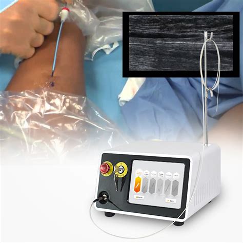 Evlt Varicose Veins Surgical Laser Dental Diode Laser Therapy Device