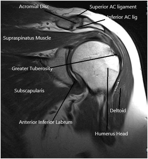 Arthroscopy Shoulder Joint Complete Orthopedics Multiple Ny Locations