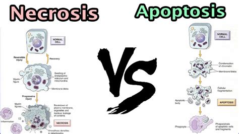 Apoptosis Necrosis