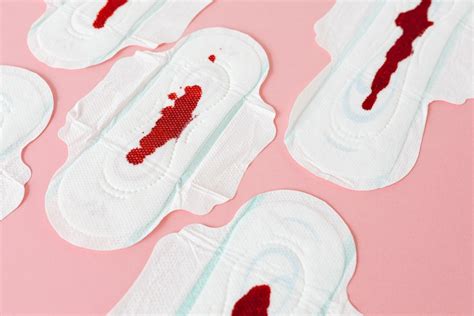 ¿es Normal La Presencia De Coágulos Menstruales Durante El Período