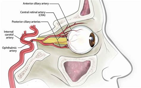 Amaurosis fugax causes, symptoms, diagnosis, prognosis and treatment