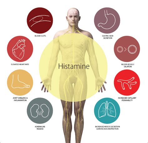 Mast Cell Activation Syndrome, IBS, Dysbiosis, SIBO - Advanced Healing