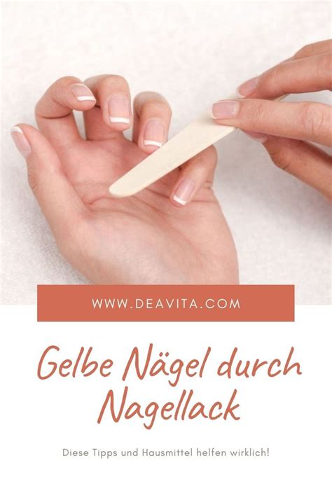 Gelbe Nägel durch Nagellack Diese Tipps und Hausmittel helfen wirklich