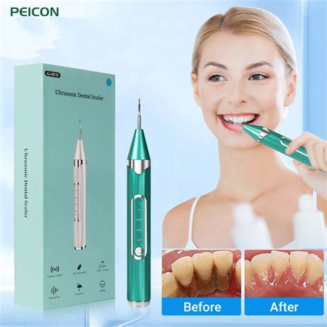 Ultrasonic Dental Scaler Removedor De T Rtaro Para Dentes Remo O De