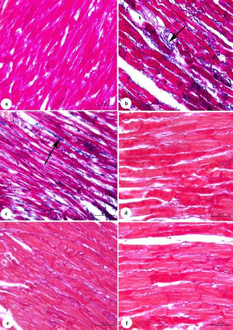 Photomicrograph Of Massons Trichrome Stained Cardiac Tissue Section Of Download Scientific