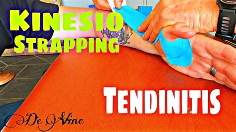 How To Strap A Wrist Tendinitis Kinesio Taping Youtube