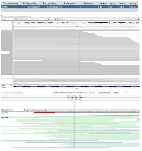 Figures And Data In Trio Based Whole Exome Sequencing In Patients With