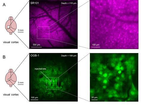 Figure From In Vivo One Photon Confocal Calcium Imaging Of Neuronal