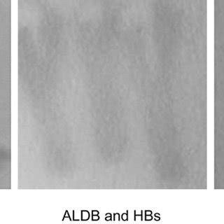 X-gal assay indicated the interaction between ALDB and HBs (middle ...