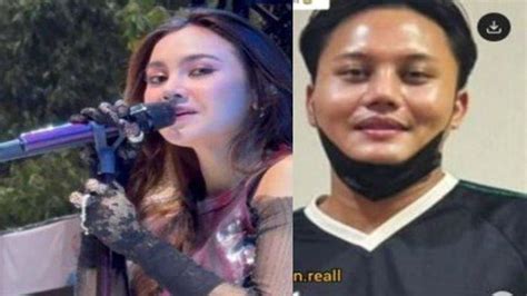 Bikin Fans Kecewa Karena Mahalini Operasi Plastik Reaksi Rizky Febian