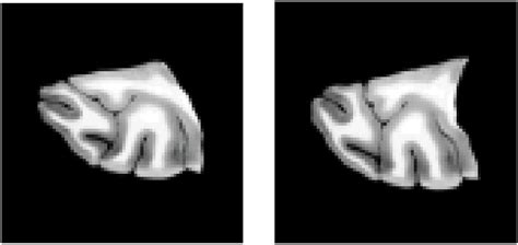 Source and target images of the 2D monkey brain experiment. | Download ...