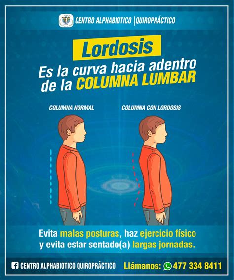 🚨 [ Lordosis ] 🚨 Es la... - Centro Alphabiotico Quiropráctico