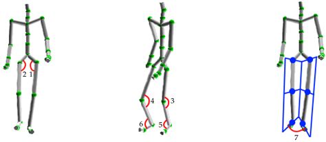 Sensors Free Full Text Skeleton Based Abnormal Gait Detection