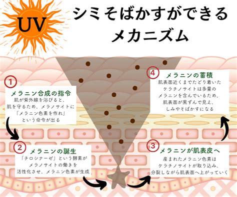 シミの種類別おすすめのレーザー治療！おすすめのクリニックは？ 美容医療を学び体験！ナールス美容医療アカデミー