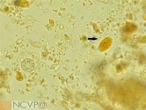 Giardia Duodenalis Cyst