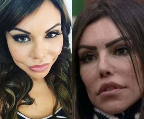 Liziane Gutierrez Antes E Depois - Imagens fortes! Veja o antes e depois de Liziane Gutierrez, de "A ...