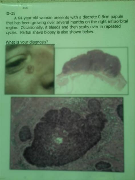 Solution Pathology Specimen Studypool