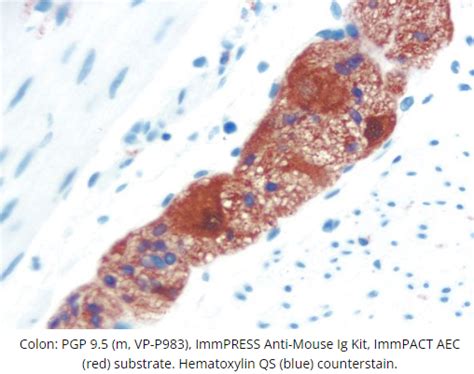 ImmPACT AEC Substrate Peroxidase HRP BIOZOL