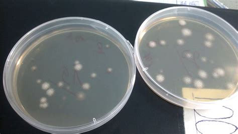 Morphology Of Bacillus Subtilis