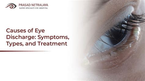 Causes of Eye Discharge: Symptoms, Types, and Treatment - Prasad Netralaya