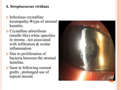 Bacterial Corneal Ulcer Drbp