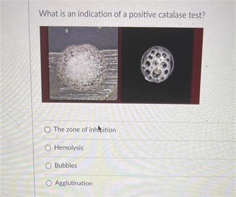 Solved What Is An Indication Of A Positive Catalase Test