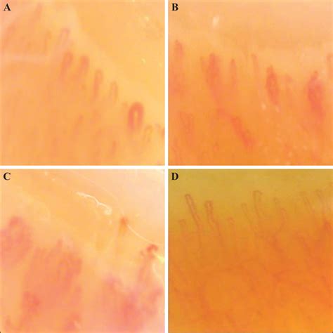 Jle European Journal Of Dermatology In Vivo Reflectance Confocal