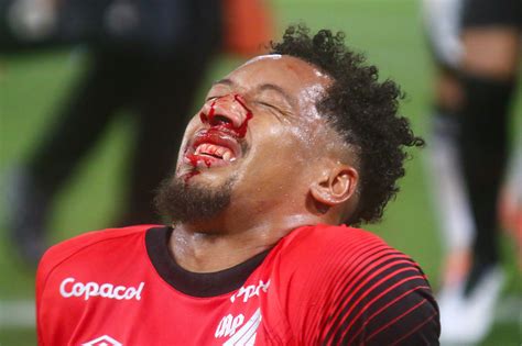 Athletico: Habraão sofre trauma na face após choque de cabeça | Ge