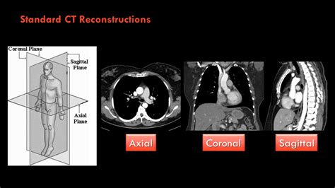 Radiology Quiz 138333 Radiopaedia Org Playlist Year 2