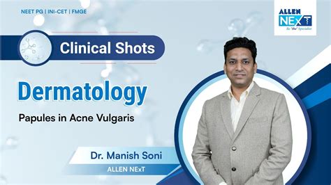 Clinical Shots Dermatology Papules In Acne Vulgaris Dr Manish