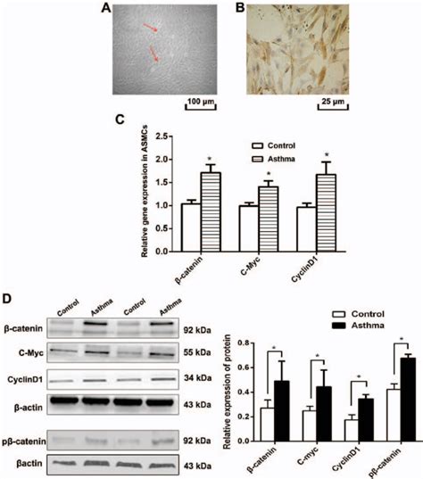 Expression Of β Catenin P β Cateninβ Catenin C Myc And Cyclin D1 In Download Scientific