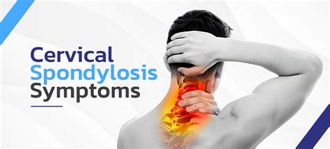 Cervical spondylosis symptoms Copy