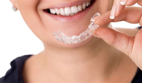 What To Expect During Invisalign Treatment