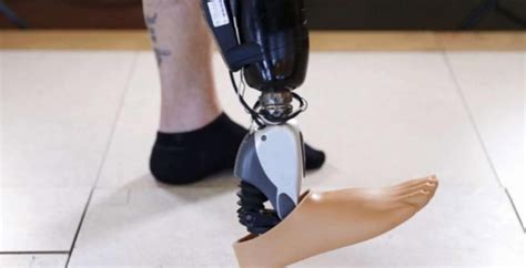 Mind-Controlled Bionic Prosthetic Legs Unveiled By Ossur - SlashGear