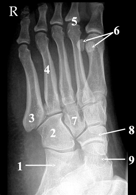 Internal Oblique Foot Diagram Quizlet