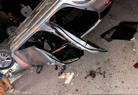 Pareja De Novios Pierden Los Brazos Tras TrÁgico Accidente Hechicera