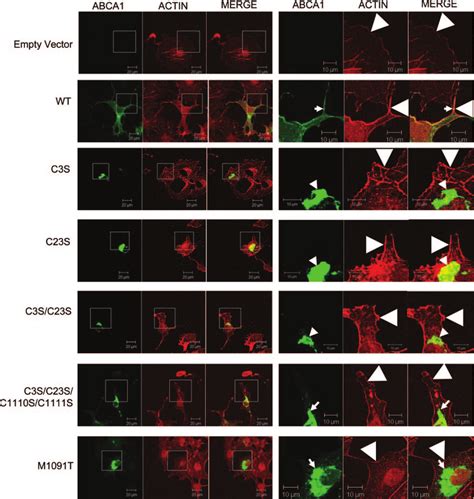 Palmitoylation Is Essential For The Plasma Membrane Localization Of