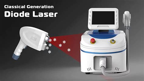 5 Points to Define a Good Laser Depilation Machine - Stelle Laser