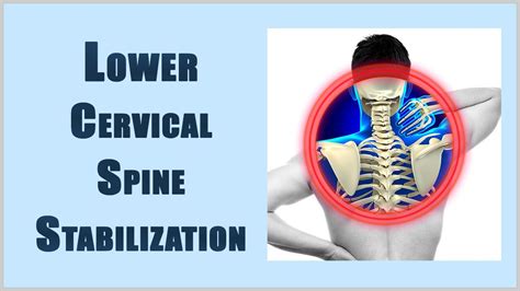 Cervical Stabilization Exercises For The Lower Cervical And Upper