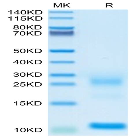 Biotinylated Human TSLP Protein TSP HM401B KACTUS Biosystems Ushelf