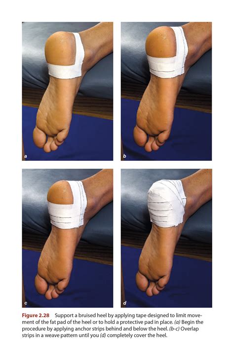 How To Help Shin Splints | Examples and Forms