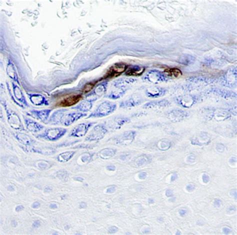 Human Patched Ptch First Extracellular Loop Antibody R D Systems