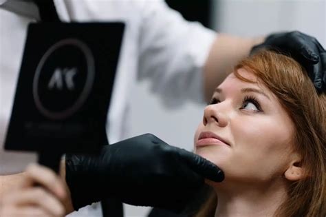 rosacea treatment  newcastle dr kane aesthetics