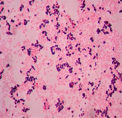 Gram Staining.pdf - Gram Staining - Virtual Lab Instructions: Work your ...