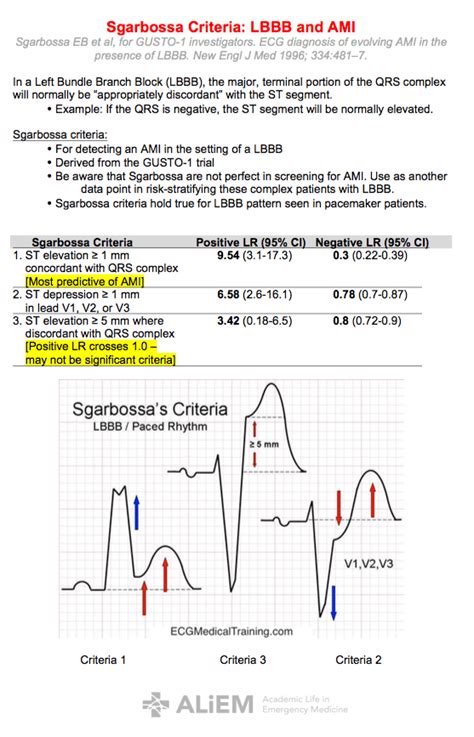 Paucis Verbis: Sgarbossa's Criteria with LBBB