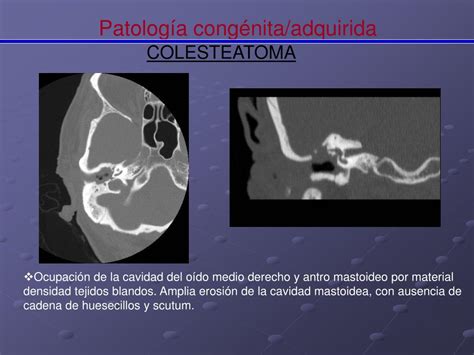 Ppt Papel Del Tcmd En El Diagn Stico De La Patolog A De O Do