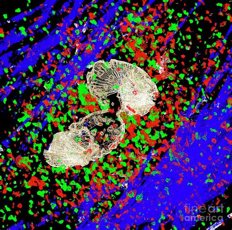 Heart Muscle Cell #1 by R. Bick, B. Poindexter, Ut Medical School ...