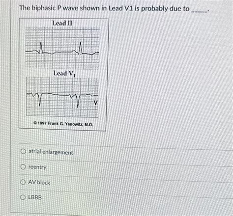 Solved The biphasic P wave shown in Lead V1 is probably due | Chegg.com